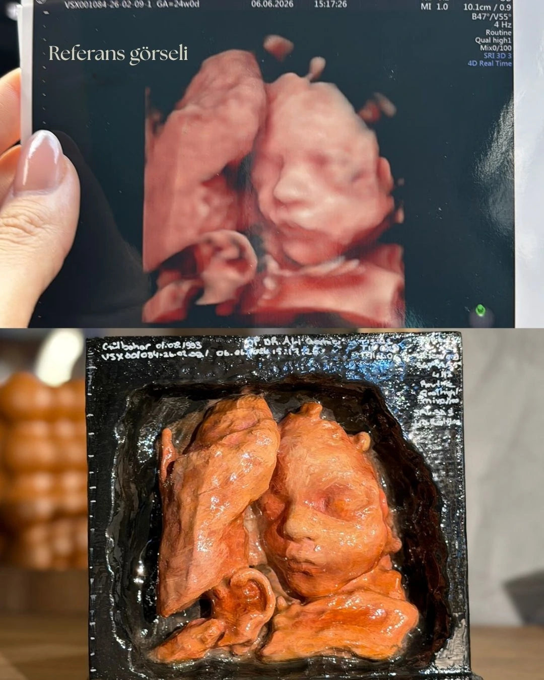 Hamilelik ultrason fotoğrafından 3 boyutlu modelleme ile üretilen kişiselleştirilmiş bebek heykeli tasarımı.